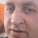 Rash, 43 года