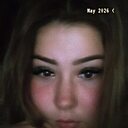 Kiss Kiss, 21 год